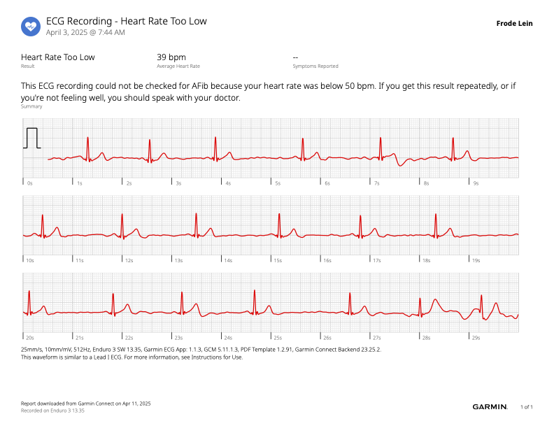 måle EKG